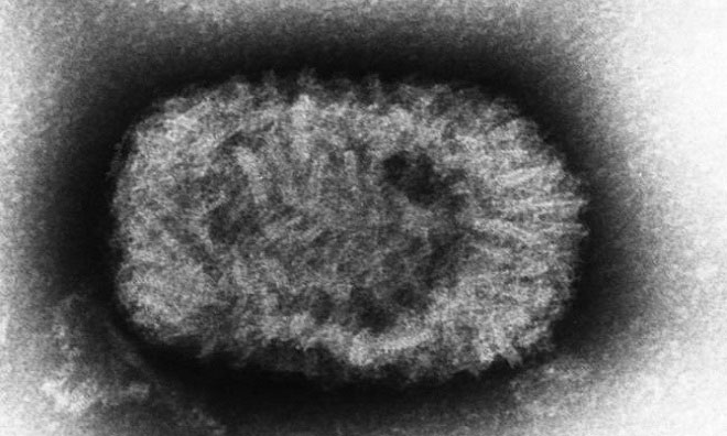 Picture 5 of The dangerous viruses on Earth