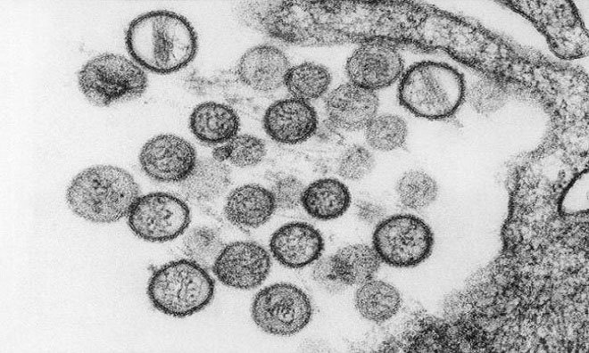 Picture 6 of The dangerous viruses on Earth