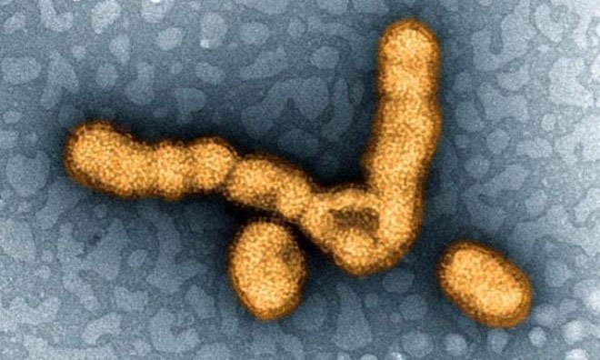 Picture 7 of The dangerous viruses on Earth