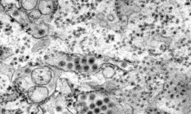 Picture 8 of The dangerous viruses on Earth