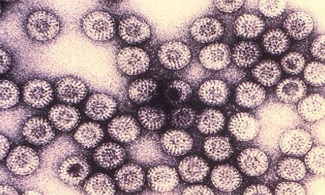 Picture 9 of The dangerous viruses on Earth
