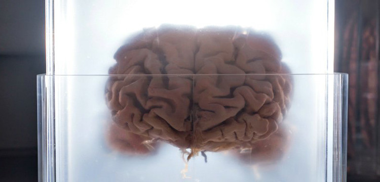 Picture 1 of The discovery explains why people are more susceptible to neurological diseases than other species