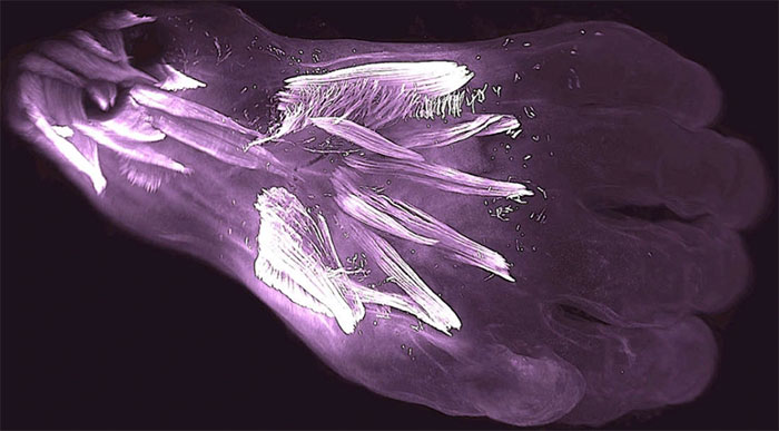 Picture 1 of The discovery of 'muscle disappearing' in humans more than 250 million years ago