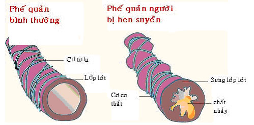 Picture 2 of The disease is common in the winter