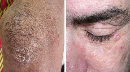 Picture 4 of The disease syndrome makes people special