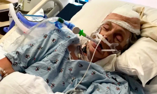 Picture 1 of The dying grandmother revived, making medicine unexplainable