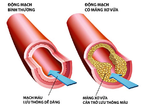 Picture 1 of The elixir helps you reduce blood fat
