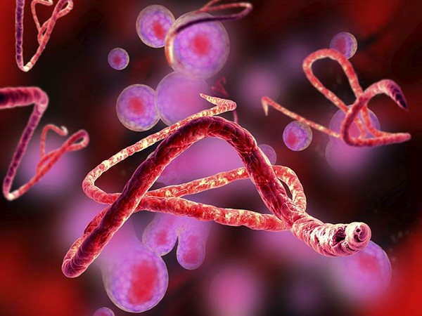 Picture 4 of The eye changes color after curing Ebola