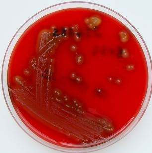 The fast-growing cannibalism bacteria