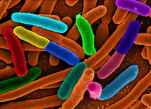 Picture 1 of The fatal E.coli bacterium in Europe is a new, highly toxic strain
