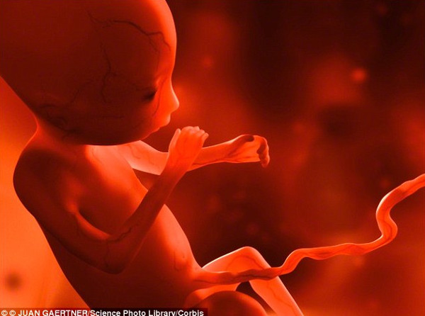 Picture 1 of The fetus was discovered in a 4-year-old boy's abdomen
