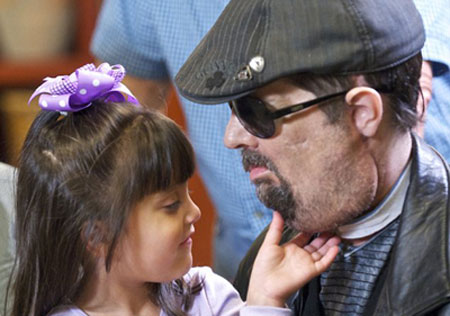 Picture 3 of The first comprehensive face transplant in the United States to meet the press