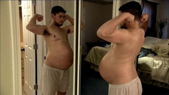 Picture 1 of The first man in Europe gave birth