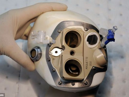 Picture 1 of The first patient in the world to install an artificial heart died