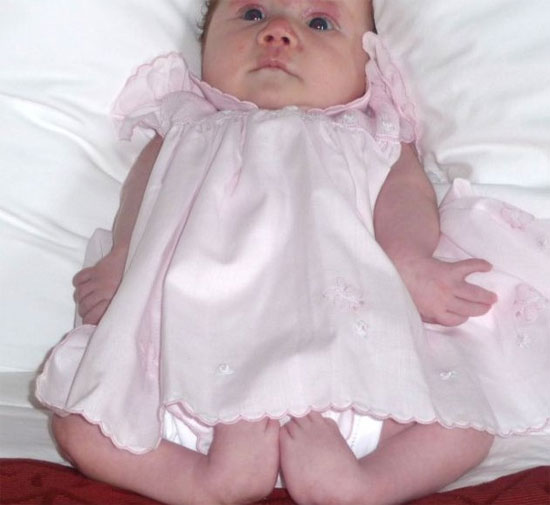 Picture 1 of The first step of a little girl with