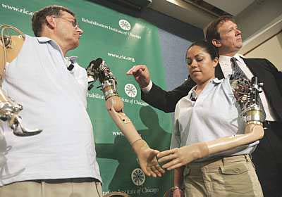 The first woman to have a biological arm images 2