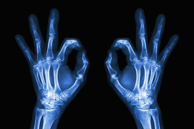 Picture 6 of The first X-ray image made his wife invent it to be startled