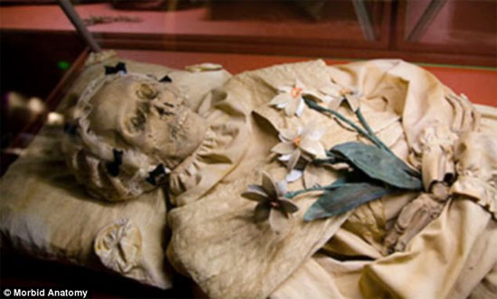 Picture 1 of The germ of TB germs in a 200-year mummy