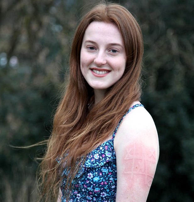 Picture 1 of The girl who used her hand to write letters on her skin felt like a miracle