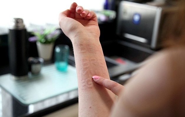 Picture 3 of The girl who used her hand to write letters on her skin felt like a miracle