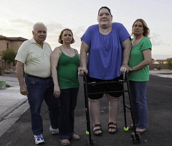 Picture 3 of The girl with the syndrome of