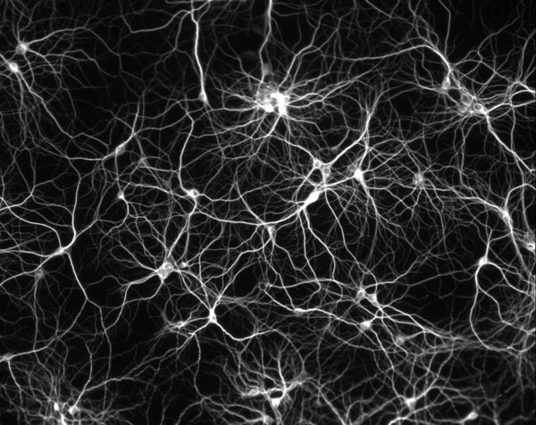 Picture 1 of The human brain has been reduced to 14 billion neurons