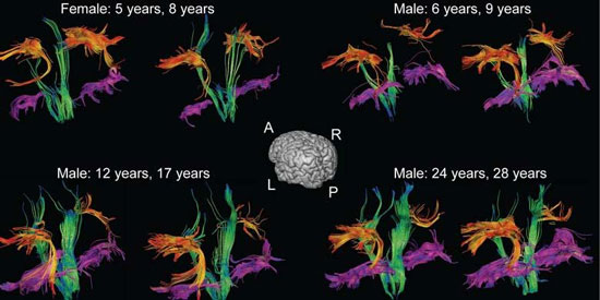 Picture 1 of The human brain still grows as an adult?