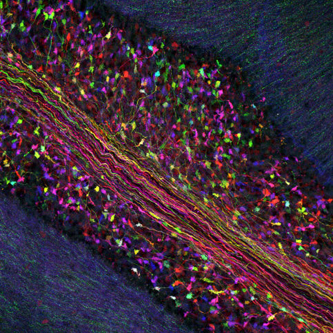 Picture 5 of The human mind was re-sketched beautifully