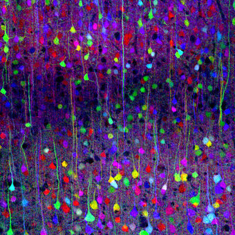 Picture 6 of The human mind was re-sketched beautifully