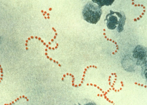 Picture 1 of The human parasite-eating monsters