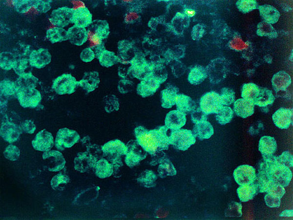Picture 5 of The human parasite-eating monsters