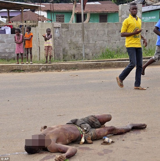 Picture 19 of The images make the world distress at Ebola