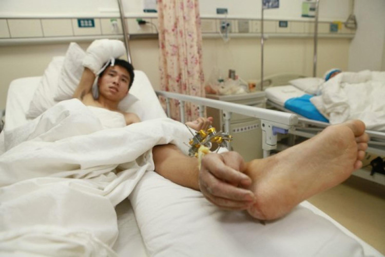 Picture 2 of The implant has a hand that is nourished on the leg