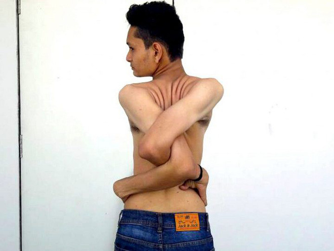 Picture 6 of The Indian boy has a flexible body like rubber, 360 degrees of his shoulders and a 180-degree neck