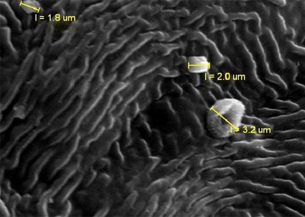 Picture 1 of The leaves indicate pollution levels