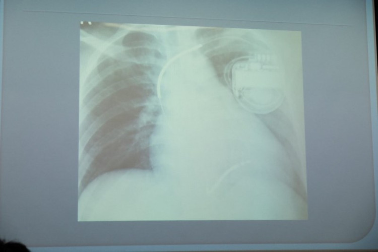 Picture 3 of The lethal strange disease for the first time recorded in Vietnam