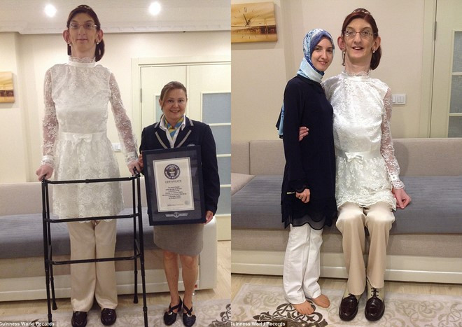 Picture 1 of The life associated with the wheelchair of the tallest girl in the world