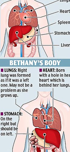 Picture 2 of The little girl has five organs turned upside down