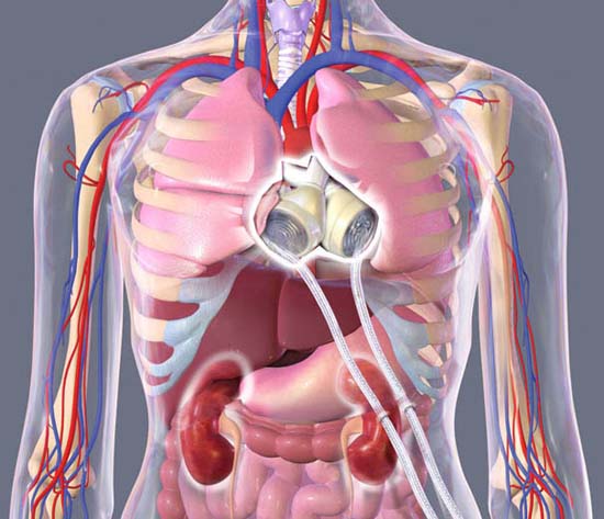 Picture 3 of The man carries a plastic heart
