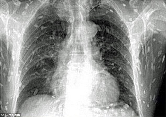 Picture 4 of The man eating sashimi felt itchy, taking X-ray images of scary images