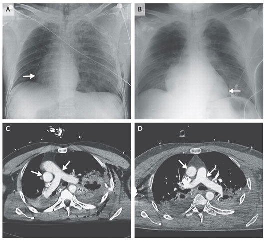 Picture 1 of The man has a 'walking' heart in his chest