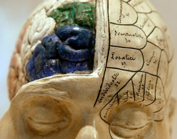 Picture 3 of The man lives normally without 90% of the brain