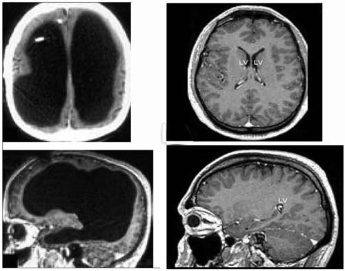 Picture 1 of The man shocked with the tiny brain