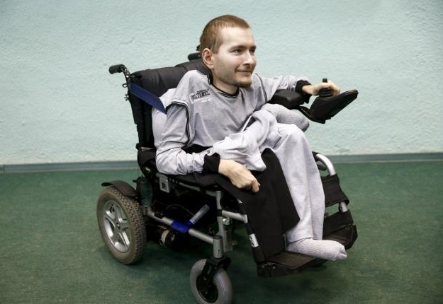 Picture 1 of The man who is about to have a head transplant surgery: