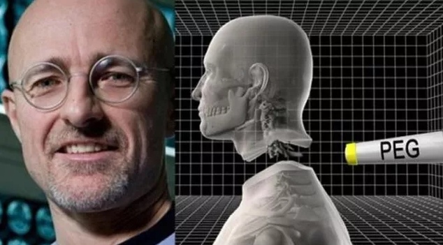 Picture 3 of The man who is about to have a head transplant surgery: