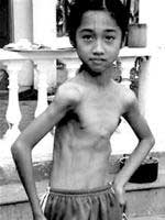 Picture 1 of The Ministry of Health established the Council for Research on Muscle Atrophy