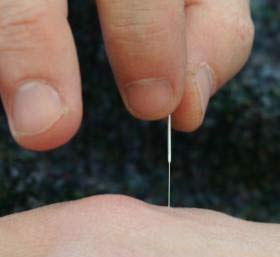 Picture 1 of The miracle of healing when not sick