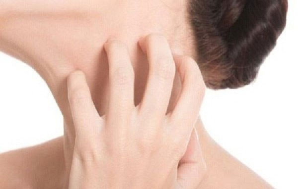 Picture 2 of The more the cause of itching, the more it causes itching