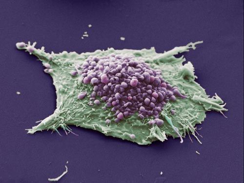 Picture 11 of The most breakthrough scientific images in 2009