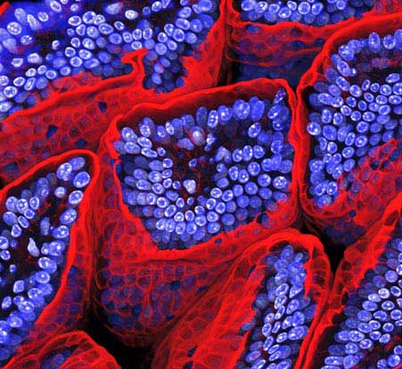 Picture 5 of The most breakthrough scientific images in 2009